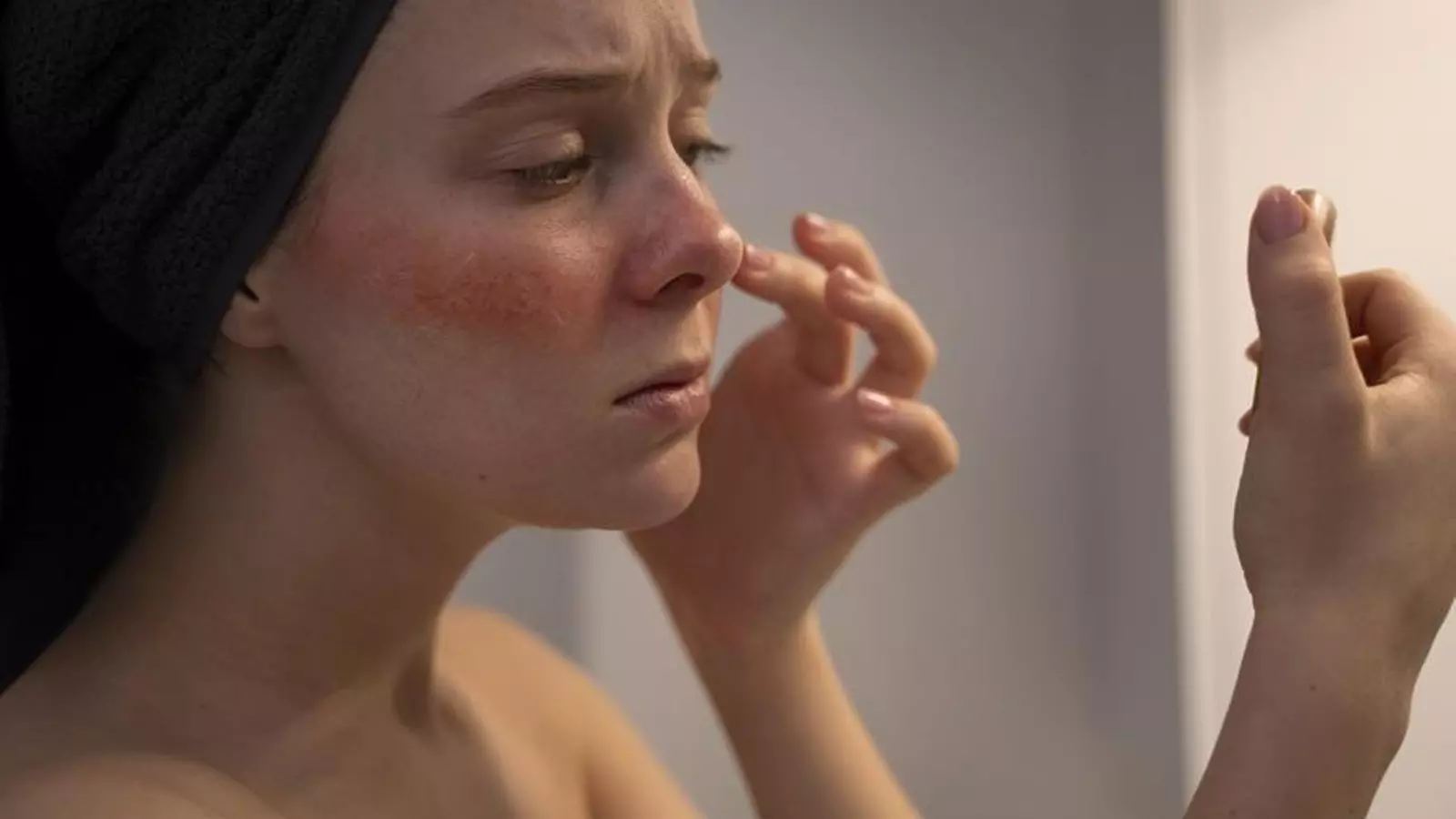 El lupus, una enfermedad aún invisible para el sistema sanitario