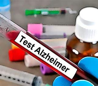 Análisis de sangre para predecir el alzhéimer: comienza una nueva era en la prevención